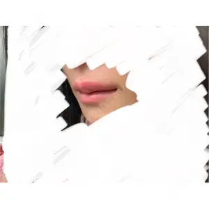 プロクリニック PRO CLINIC プロクリニック 銀座院口コミ