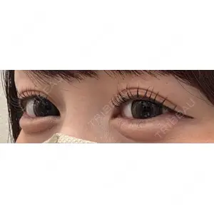 さっぽろ美容クリニック口コミ