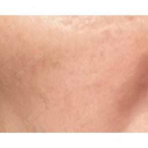 BITO BEAUTY CLINIC BITO BEAUTY CLINIC口コミ
