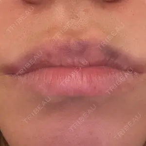 HAAB CLINIC HAAB BEAUTY CLINIC 名古屋院口コミ