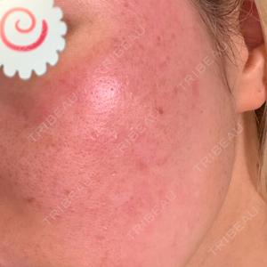 BITO BEAUTY CLINIC BITO BEAUTY CLINIC口コミ