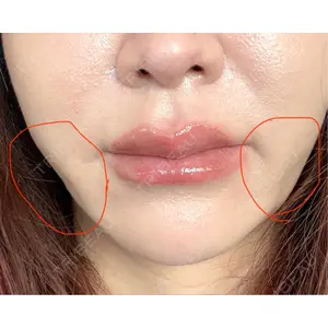 HAAB×DREAM BEAUTY CLINIC 大阪梅田院の