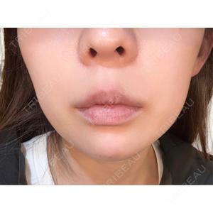 LIFIX BEAUTY CLINIC口コミ