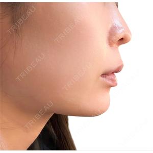LIFIX BEAUTY CLINIC口コミ