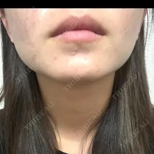 ルラ美容クリニック ルラ美容クリニック 岐阜院口コミ