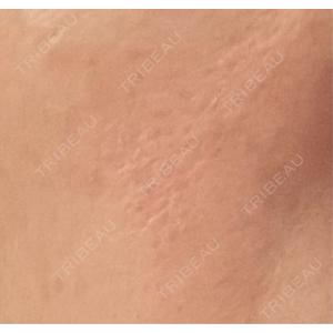 BITO BEAUTY CLINIC BITO BEAUTY CLINIC口コミ