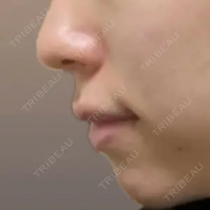 アネシス美容クリニック口コミ