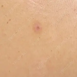 Wクリニック Wクリニック 心斎橋院口コミ