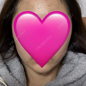 ARTE BEAUTY CLINIC口コミ