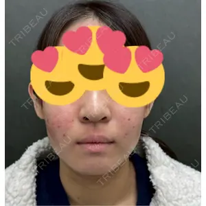 Nebula Clinic ネビュラクリニック 京都院口コミ