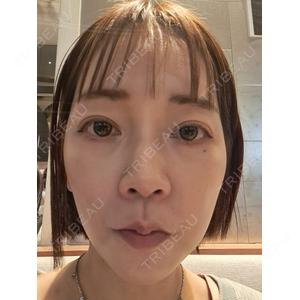 共立美容外科・歯科 共立美容外科 梅田院口コミ