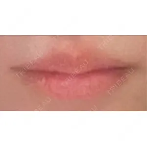 オーキッド美容クリニック東京御徒町口コミ