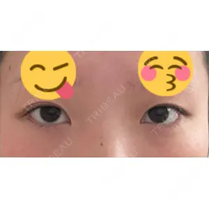 LUHO（ルホ）美容外科口コミ
