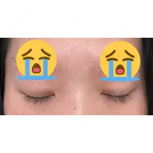LUHO（ルホ）美容外科口コミ