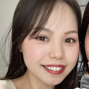 HAAB CLINIC HAAB×DREAM BEAUTY CLINIC 大阪梅田院口コミ