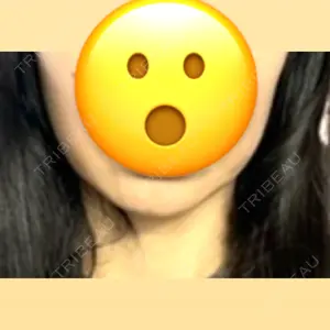 アムルーズ美容外科クリニック アムルーズ美容外科クリニック 大阪院口コミ