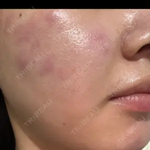 ルラ美容クリニック ルラ美容クリニック 広島院口コミ