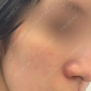 ルラ美容クリニック ルラ美容クリニック 高田馬場院口コミ