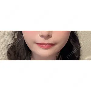 口コミ