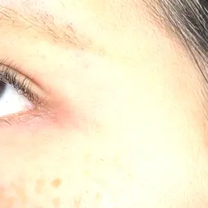 藤・ナチュレ美容クリニック 藤・ナチュレ美容クリニック 銀座院口コミ
