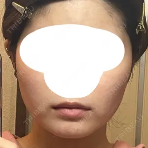 ビラビューティークリニック 小倉美容外科/美容皮膚科 ビラビューティークリニック口コミ