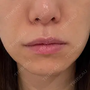 ルラ美容クリニック ルラ美容クリニック 新潟院口コミ