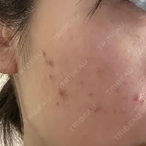 湘南美容クリニック 湘南美容クリニック 川崎院口コミ