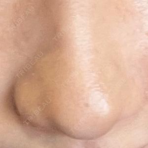 Fellez Clinic【フェルズクリニック】口コミ