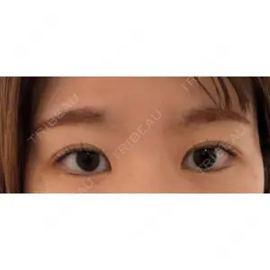 Nクリニック伏見口コミ