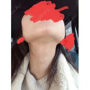 フォンタナクリニック天神口コミ