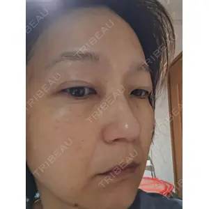 ルラ美容クリニック ルラ美容クリニック 広島院口コミ