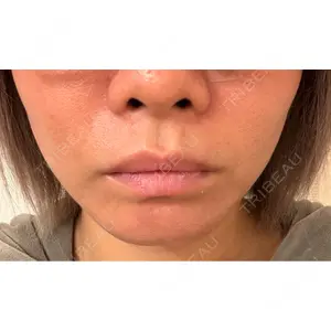 DMTC CLINIC DMTC美容皮膚科 大宮院口コミ