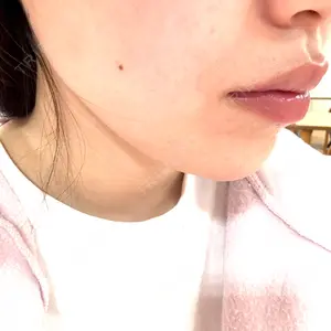 口コミ