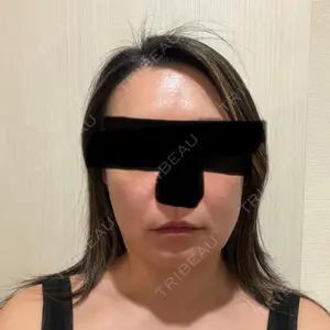 Lipo Clinic omotesando口コミ