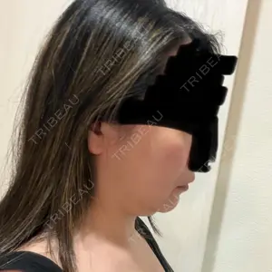 Lipo Clinic omotesando口コミ
