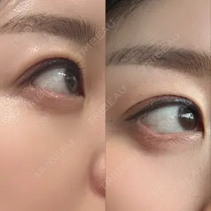 口コミ