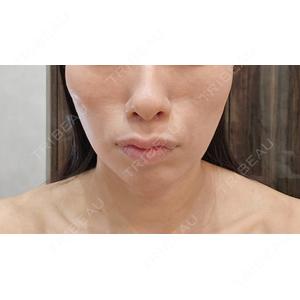 WOM CLINIC WOM SALON【術後ケア取扱いサロン】口コミ