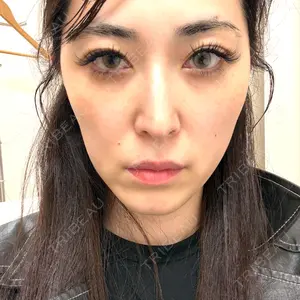 フィラークリニック フィラークリニック 大阪心斎橋院口コミ