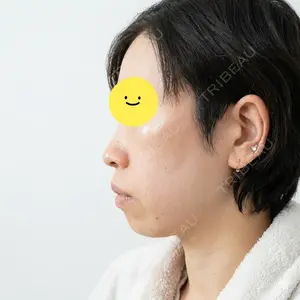 HAAB CLINIC HAAB×DREAM BEAUTY CLINIC 大阪梅田院口コミ