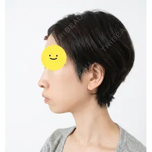 HAAB CLINIC HAAB×DREAM BEAUTY CLINIC 大阪梅田院口コミ