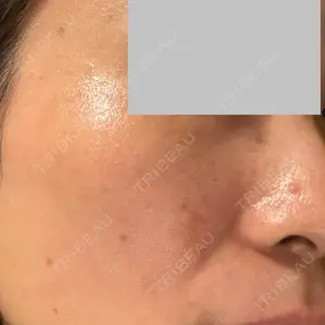 聖心美容クリニック グループ S-Laboクリニック 渋谷院口コミ