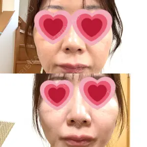 口コミ