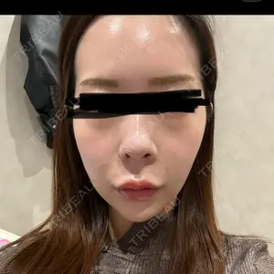 Nebula Clinic 札幌美容外科ネビュラクリニック口コミ