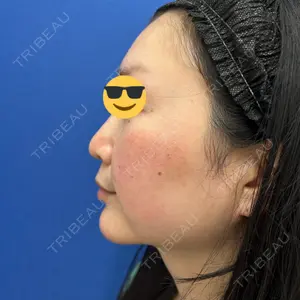 湘南美容クリニック 湘南美容クリニック 新宿南口院口コミ