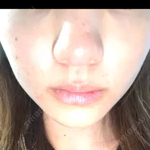 口コミ