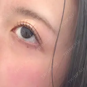 ルラ美容クリニック ルラ美容クリニック 横浜院口コミ