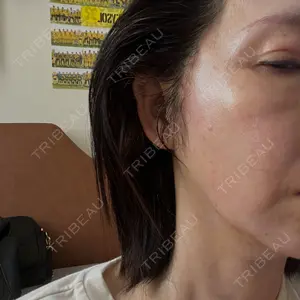 トラスト美容クリニック トラスト美容クリニック 銀座院口コミ