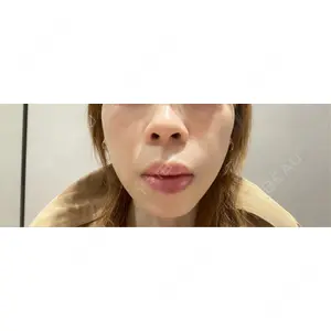フォンタナクリニック天神口コミ