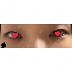 湘南美容クリニック 湘南美容クリニック 京都院口コミ