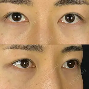 藤・ナチュレ美容クリニック 藤・ナチュレ美容クリニック 銀座院口コミ